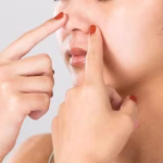 Komedo Tak Kunjung Hilang? Bisa Jadi Karena Cara Yang Salah