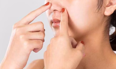 Komedo Tak Kunjung Hilang? Bisa Jadi Karena Cara Yang Salah